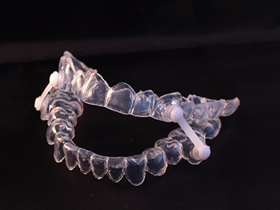Mansfield Family Dentistry | Dental Bridges, Emergency Treatment and Dental Bonding