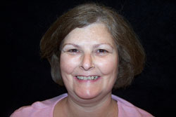 Mansfield Family Dentistry | Silent Sleep Oral Appliance, Dental Bridges and Dental Sealants