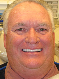 Mansfield Family Dentistry | Extractions, Inlays amp Onlays and Preventative Program