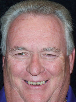 Mansfield Family Dentistry | Dental Fillings, Extractions and Sedation Dentistry