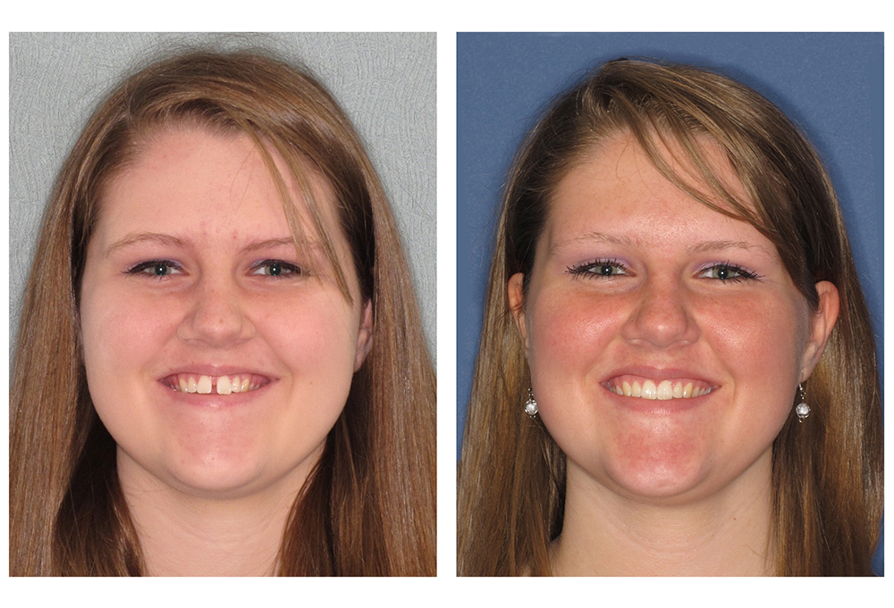 Mansfield Family Dentistry