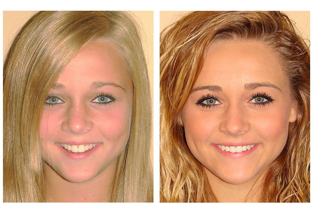 Mansfield Family Dentistry