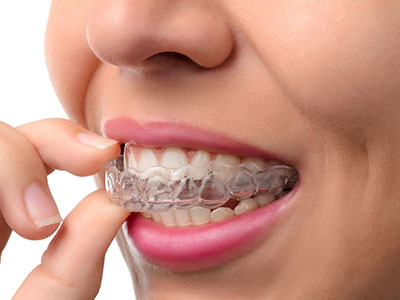 Mansfield Family Dentistry | Sedation Dentistry, Root Canals and Extractions