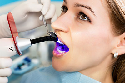 Mansfield Family Dentistry | Extractions, Dental Bonding and Inlays  amp  Onlays