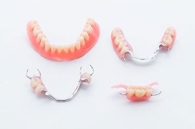 Mansfield Family Dentistry | Inlays  amp  Onlays, Dental Bridges and Implant Dentistry