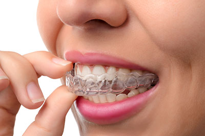 Mansfield Family Dentistry | Dentures, Emergency Treatment and Dental Sealants