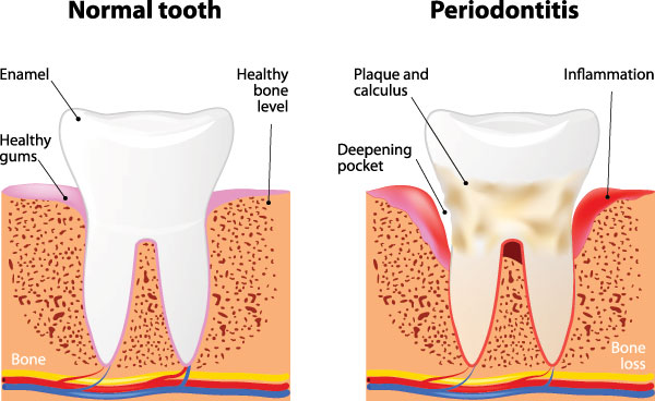 Mansfield Family Dentistry | Sedation Dentistry, Extractions and Invisalign reg 