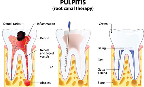 Mansfield Family Dentistry | Silent Sleep Oral Appliance, Dental Bridges and Dental Sealants