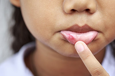 Mansfield Family Dentistry | Crowns, Silent Sleep Oral Appliance and Sedation Dentistry