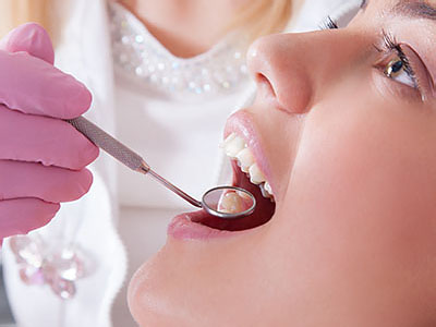 Mansfield Family Dentistry | Dentures, Dental Sealants and Dental Bonding