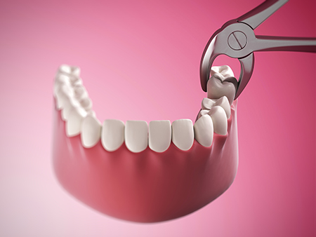 Mansfield Family Dentistry | Dental Bridges, Emergency Treatment and Dental Fillings