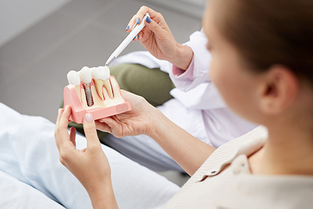 Mansfield Family Dentistry | Dental Sealants, Invisalign reg  and Dentures