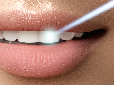 Mansfield Family Dentistry | Implant Dentistry, Dental Bridges and Cosmetic Dentistry