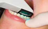 Mansfield Family Dentistry uses Cadent iTero
